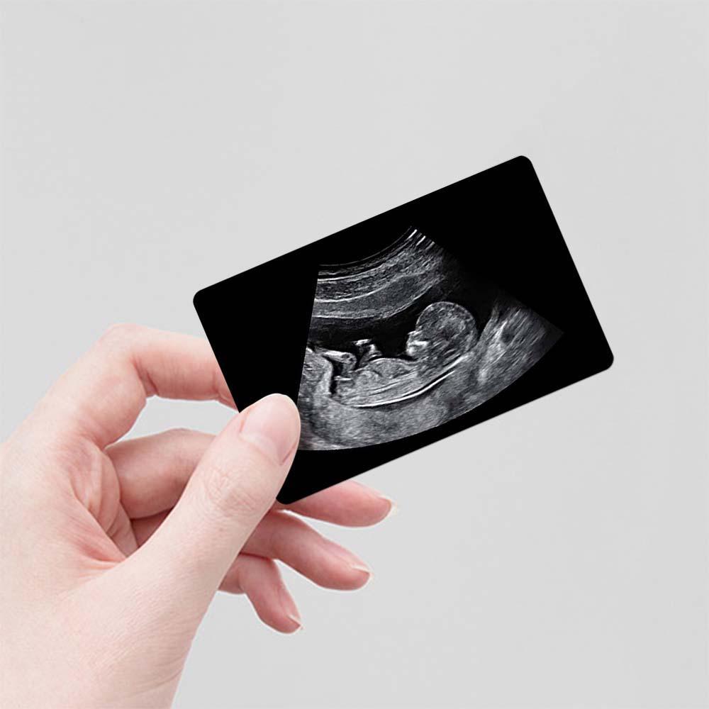 Custom Photo Engraved Ultrasound Wallet Card New Dad Pregnancy Gift - Myphotomugs