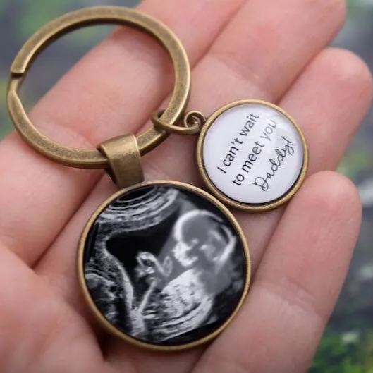 Personalized Ultrasound Photo Keychain, Pregnancy Gifts, Custom Daddy Keychain, Ultrasound Gifts, Mothers Day Gift, Father, New Dad, S-1