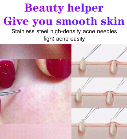 High precision and high hardness cell clamp