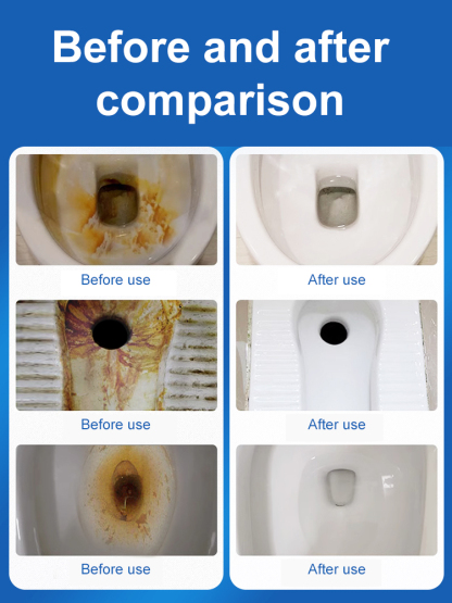 Clean hands no mess interchangeable brush head toilet brush set