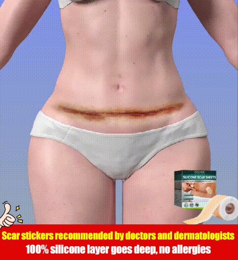 Silicone scar stickers