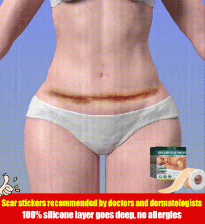 Silicone scar stickers