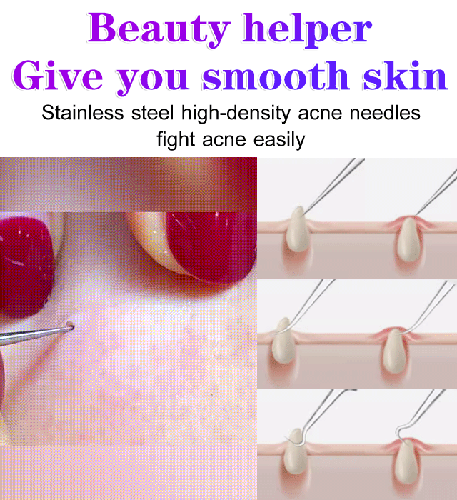 High precision and high hardness cell clamp