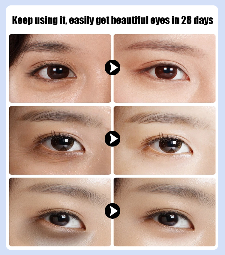 Beautiful Eye Care Device Eye Massager