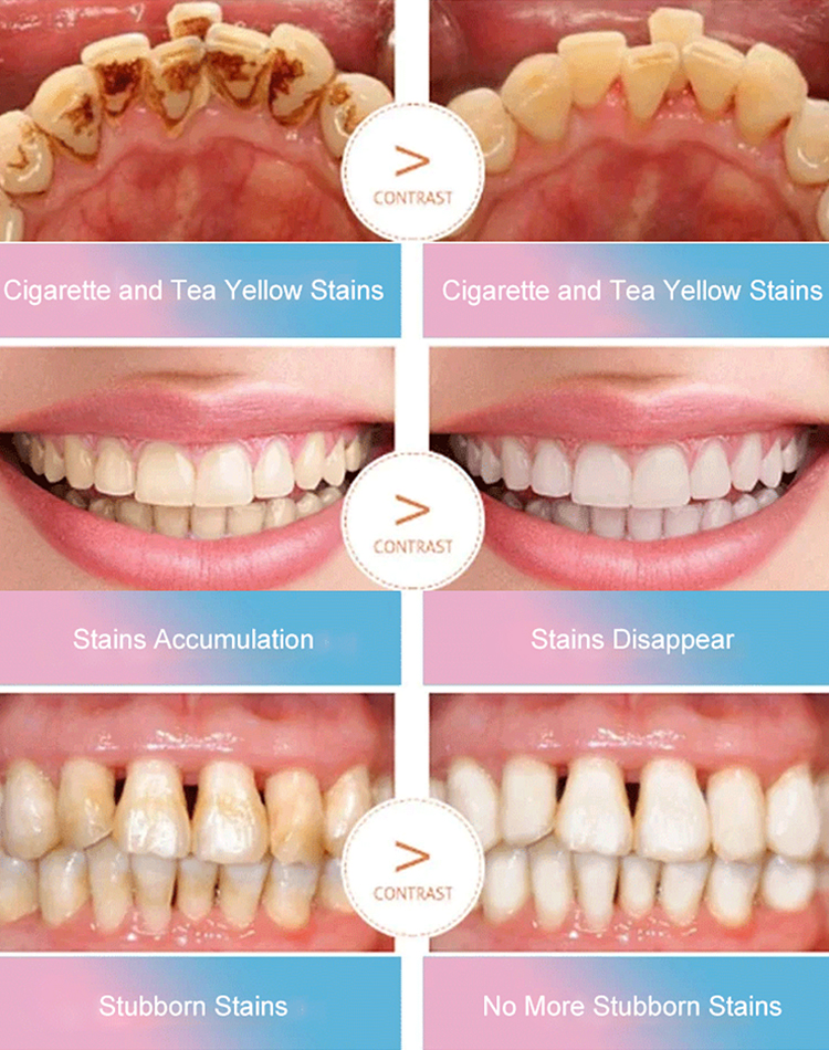  Niacinamide Bright White Toothpaste
