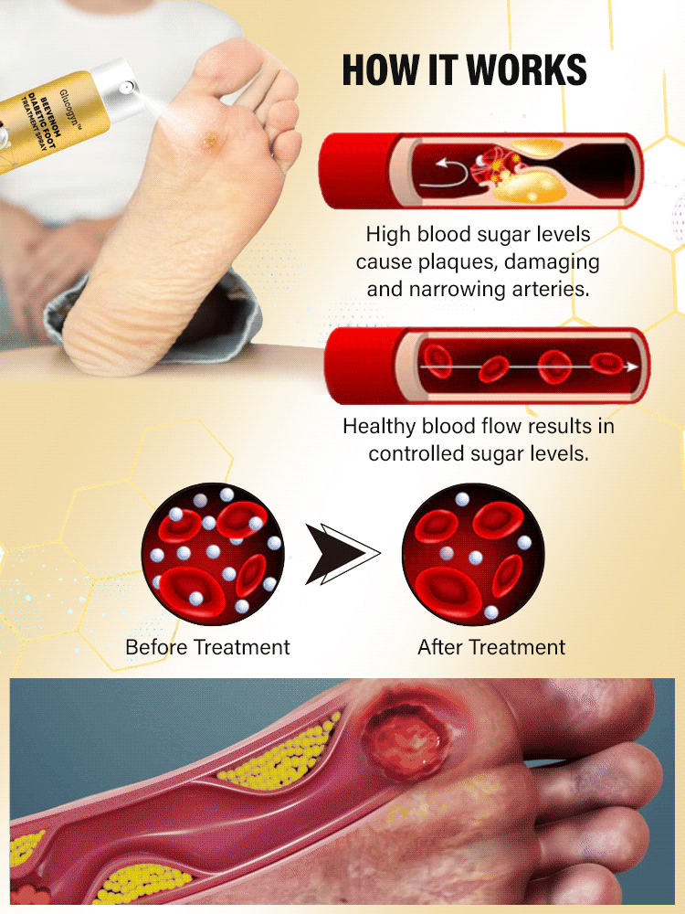 Diabetic foot treatment spray