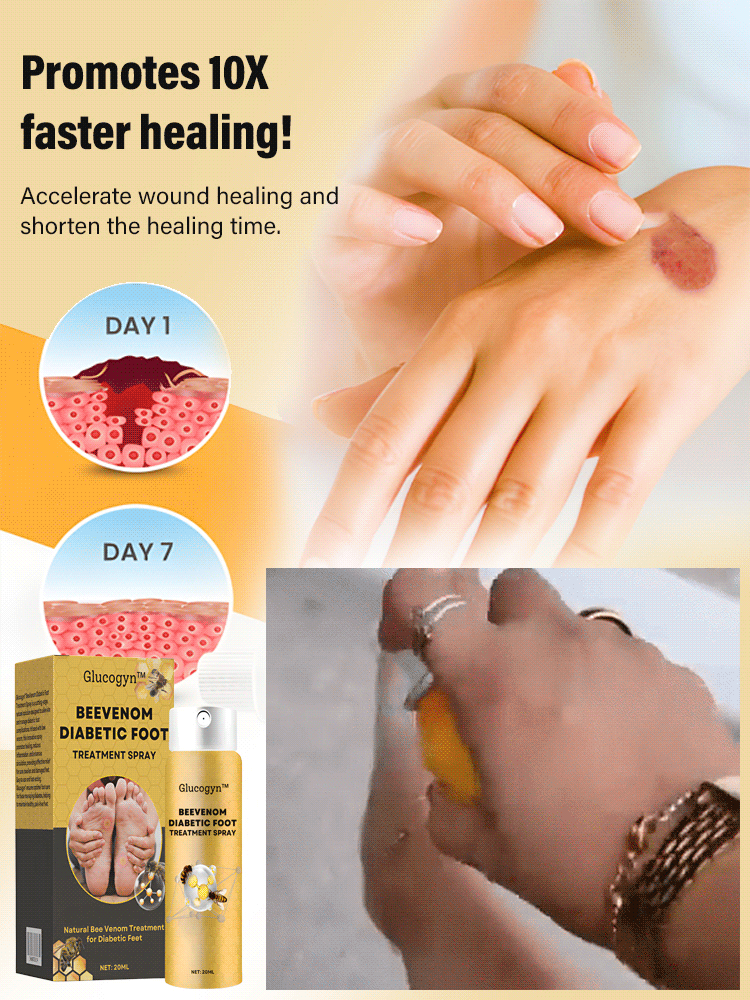 Diabetic foot treatment spray