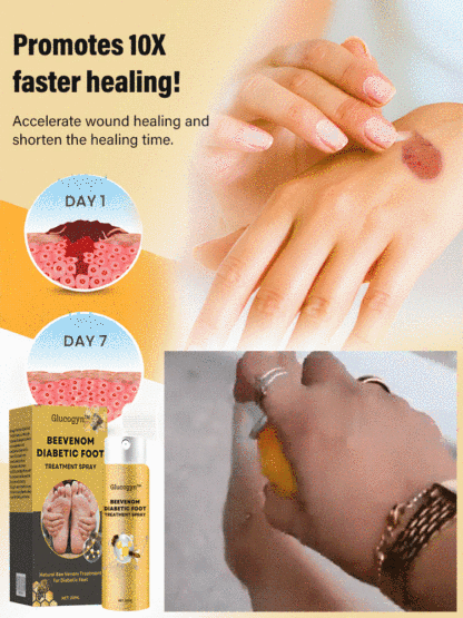 Diabetic foot treatment spray
