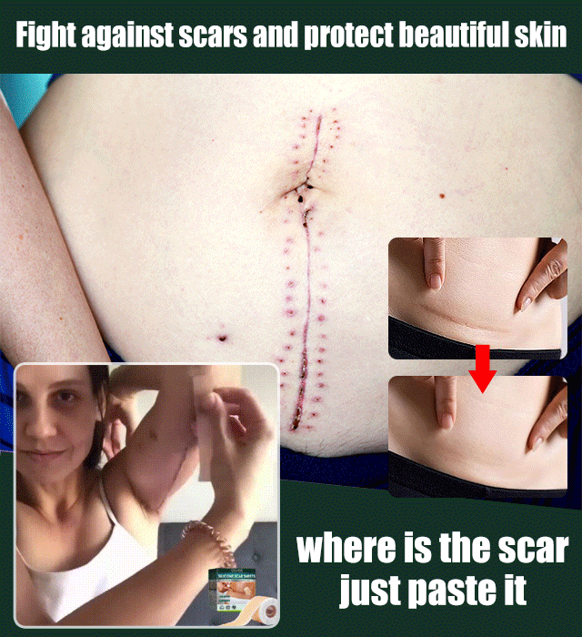 Silicone scar stickers