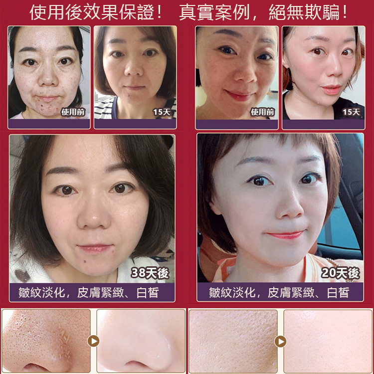 【瞬間見效】視黃醇蛇毒肽黃金面膜