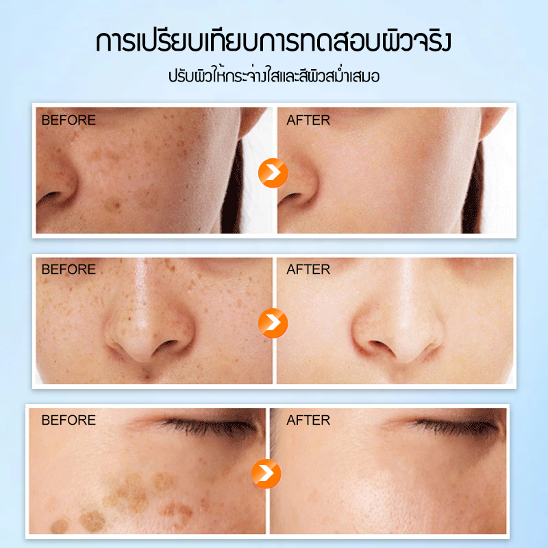 POPASKIN ครีมลดเลือนจุดด่างดำเพื่อผิวขาวกระจ่างใส