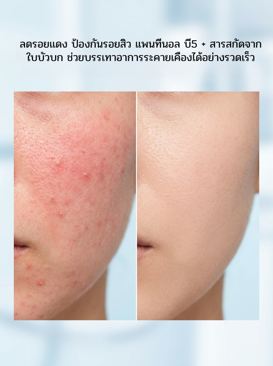 POPASKIN ครีมเสริมเกราะป้องกันผิว สูตรปลอบประโลมและเติมความชุ่มชื้น