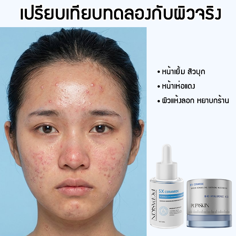  POPASKIN เซ็ตดูโอ้กู้เกราะป้องกันผิว (เซรั่ม + เจลครีม) จบปัญหาผิวแพ้ง่าย ผิวมันขาดน้ำ เติมความชุ่มชื้น 24 ชม-POPASKIN