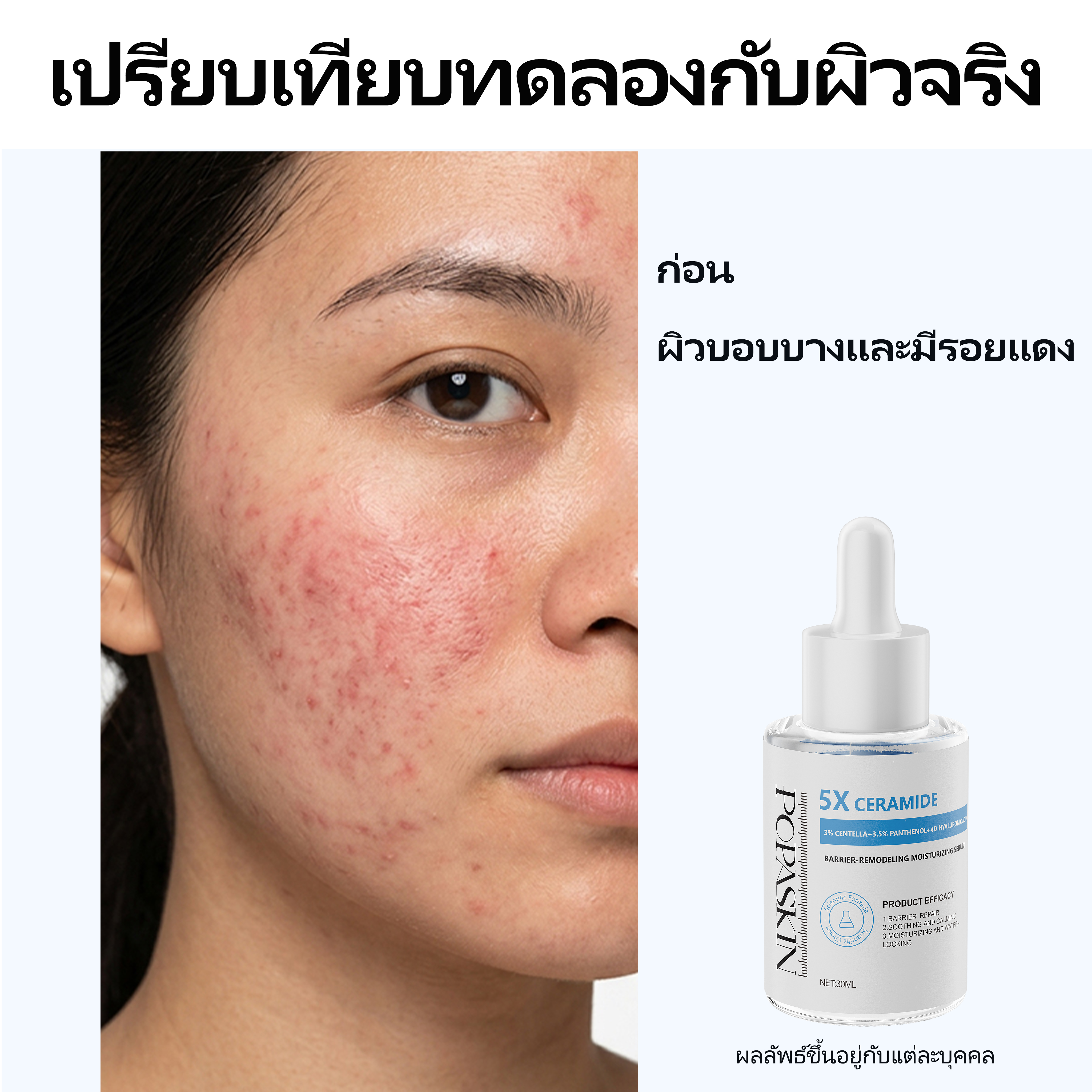 POPASKIN เซรั่มปลอบประโลมผิว เสริมเกราะป้องกันและเติมความชุ่มชื้น
