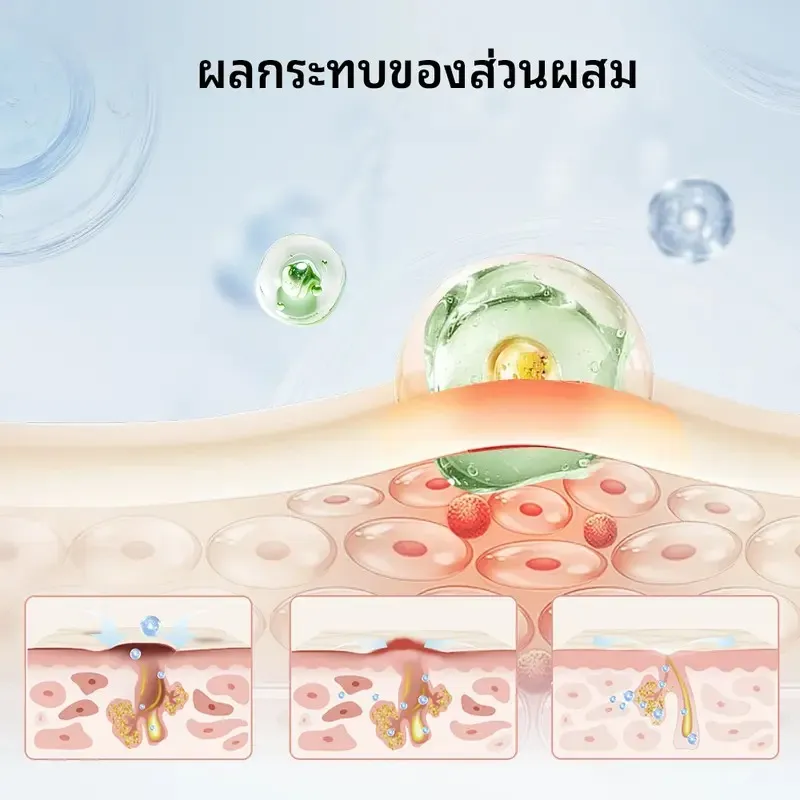 POPASKIN เซรั่มลดสิว สลายสิวอุดตัน + ลดรอยดำแดง คุมมัน รูขุมขนกระชับ (สูตรอ่อนโยน หน้าไม่บาง)
