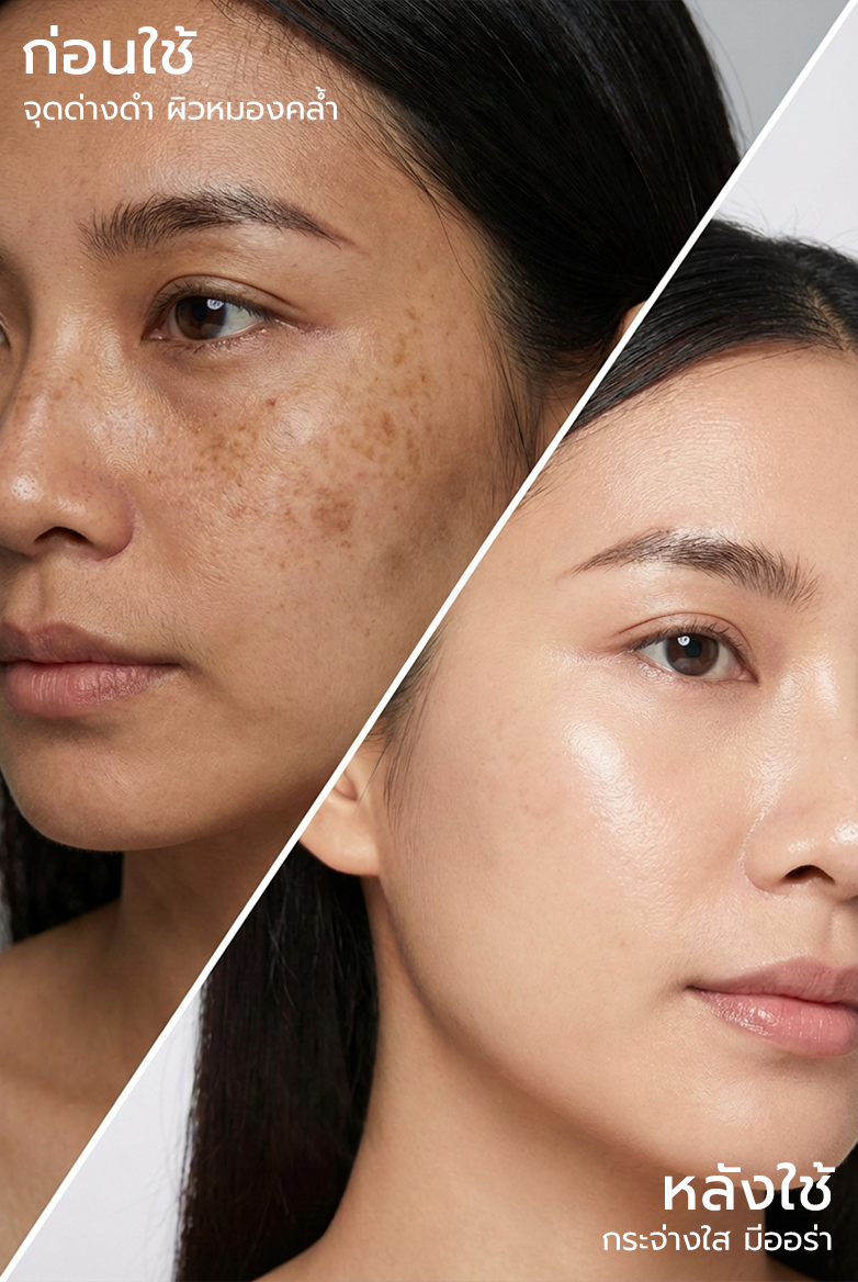 ลดจุดด่างดำ