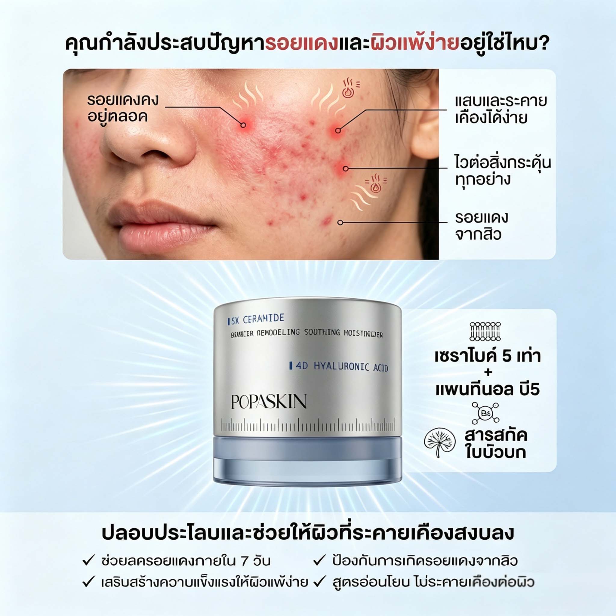 POPASKIN ครีมเสริมเกราะป้องกันผิว เติมน้ำให้ผิว จบปัญหา "ผิวมันขาดน้ำ" เนื้อบางเบา ซึมไวใน 3 วิ