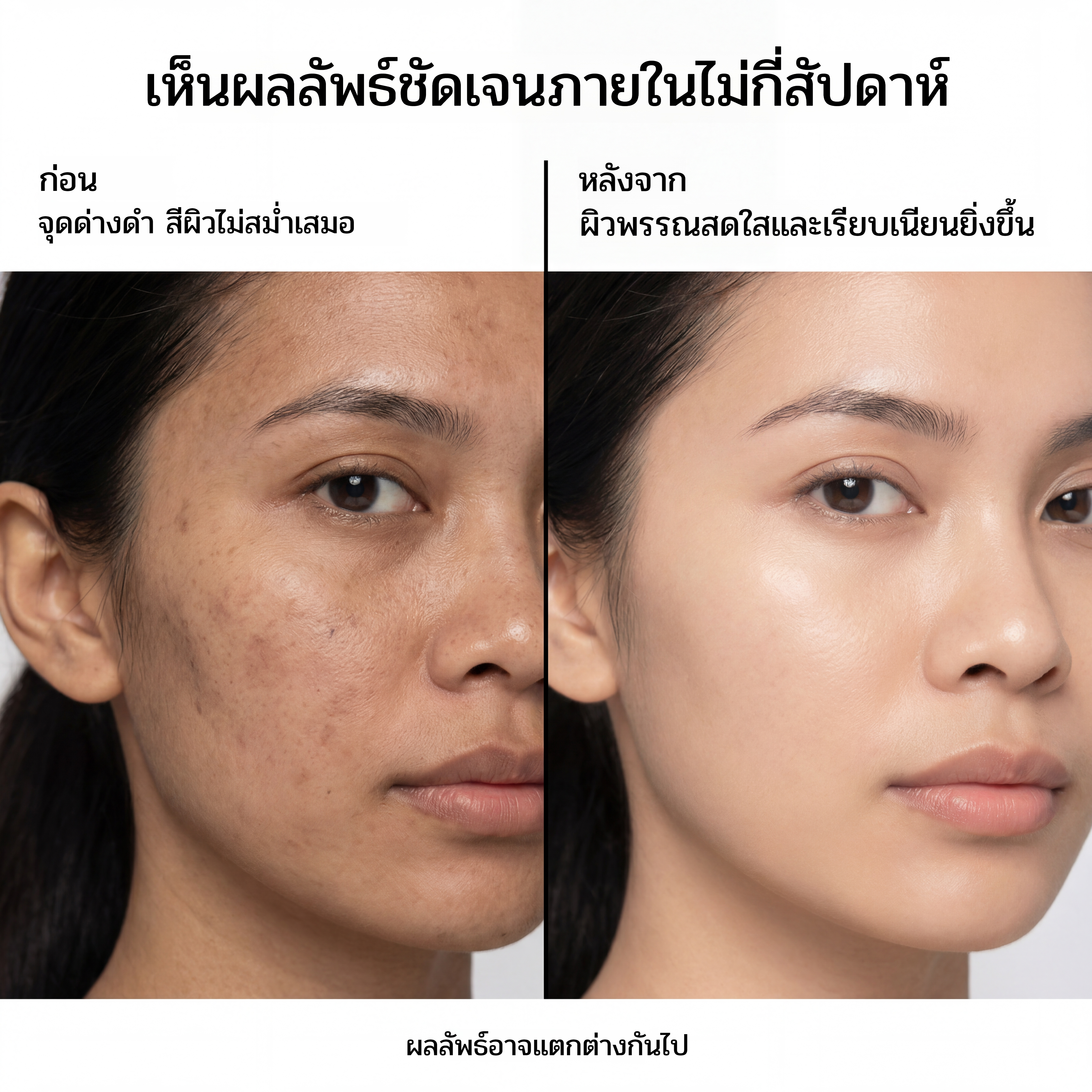 POPASKIN เซรั่มไนอะซินาไมด์ 10% สยบฝ้าแดด กระ จุดด่างดำ บูสผิวขาวใสออร่า-POPASKIN