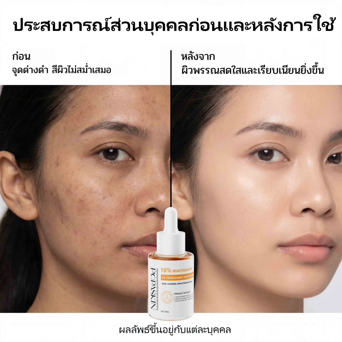 POPASKIN เซรั่มไนอะซินาไมด์ 10% สยบฝ้าแดด กระ จุดด่างดำ บูสผิวขาวใสออร่า