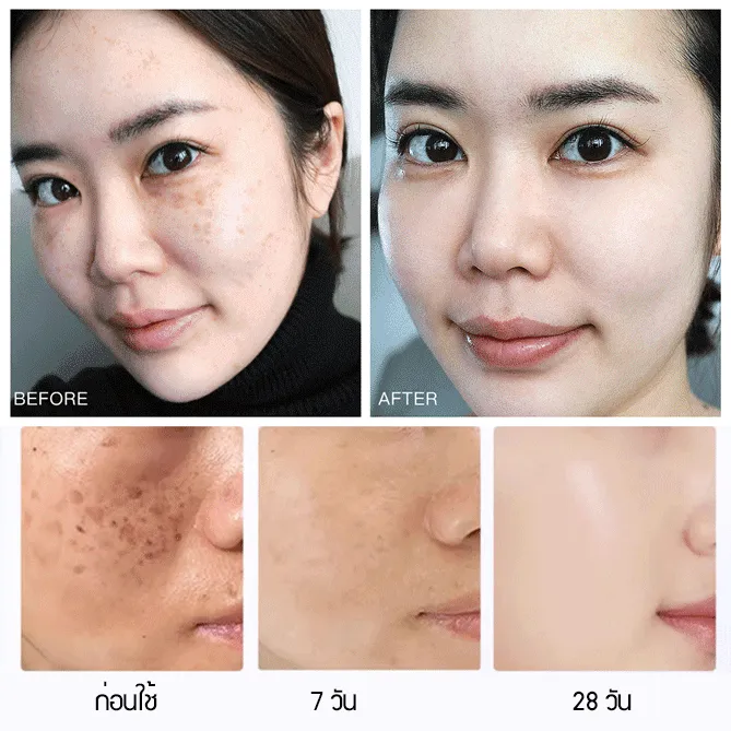 POPASKIN 577+377 เซรั่มหน้าใส ลดฝ้าแดด รอยสิวจางไว กู้ผิวโทรม 