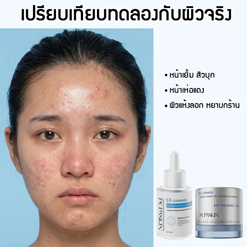 POPASKIN เซ็ตดูโอ้กู้เกราะป้องกันผิว (เซรั่ม + เจลครีม) จบปัญหาผิวแพ้ง่าย ผิวมันขาดน้ำ เติมความชุ่มชื้น 24 ชม