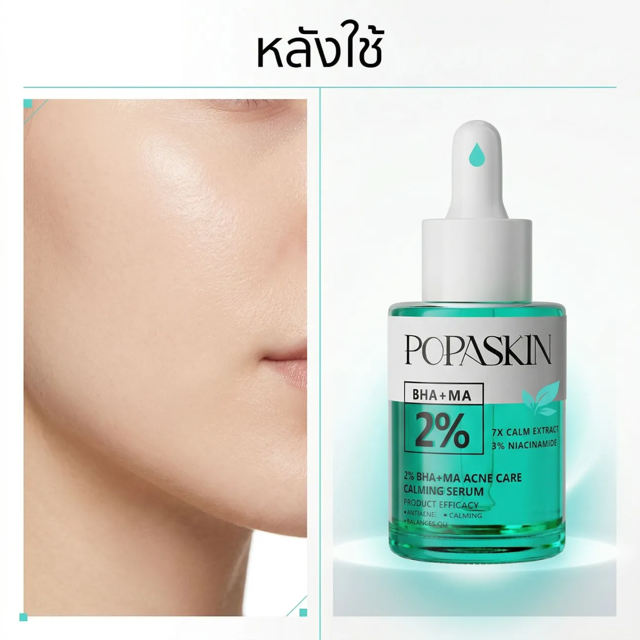 POPASKIN เซรั่มลดสิว สลายสิวอุดตัน + ลดรอยดำแดง คุมมัน รูขุมขนกระชับ (สูตรอ่อนโยน หน้าไม่บาง)