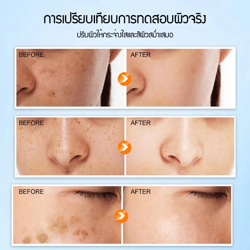 POPASKIN ครีมลดเลือนจุดด่างดำเพื่อผิวขาวกระจ่างใส
