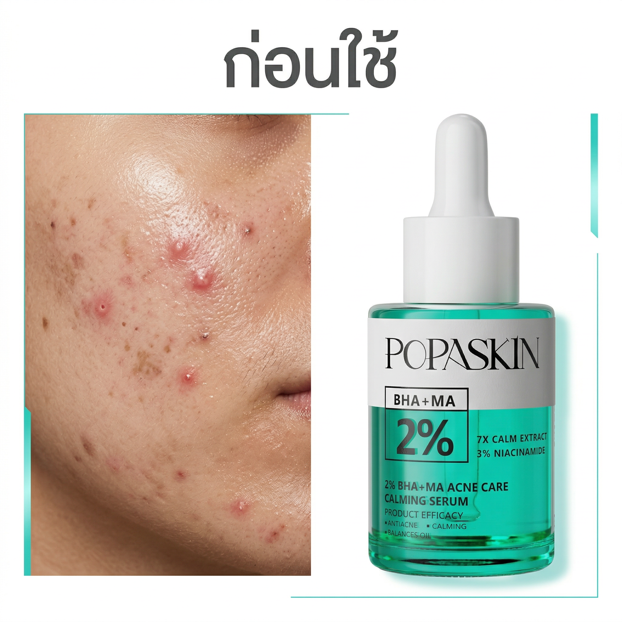 POPASKIN เซรั่มจัดการสิว ผลัดเซลล์ผิวและปรับสมดุลผิวให้แข็งแรง