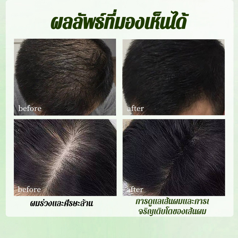 สบู่ปลูกผมสมุนไพร สบู่ทําความสะอาดผมป้องกันผมร่วงด้วยมือล้วนๆ