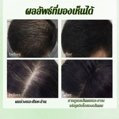 สบู่ปลูกผมสมุนไพร สบู่ทําความสะอาดผมป้องกันผมร่วงด้วยมือล้วนๆ