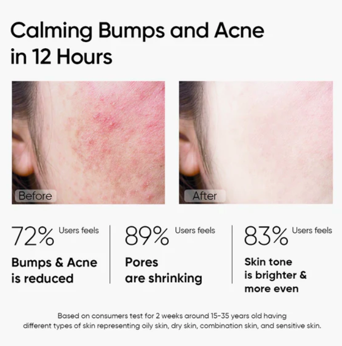 SKINTIFIC MUGWORT MASK ANTI PORES & ACNE CLAY MASK 55G,  (SS3)