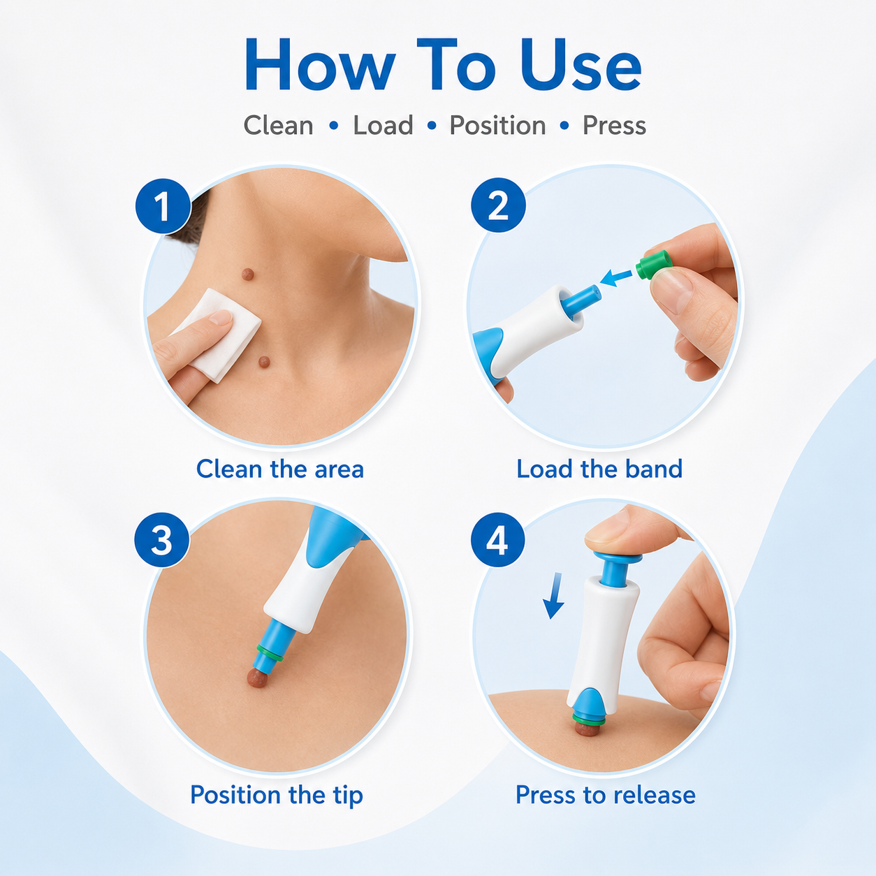 Auto skin tag removal kit with dual size applicators and micro bands