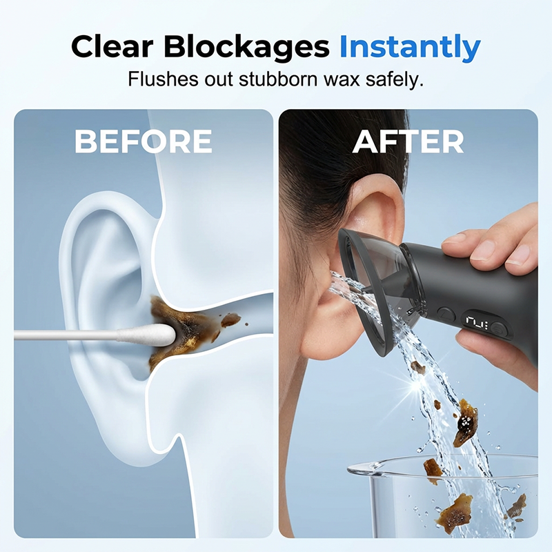 Water-powered ear cleaner concept compared with cotton swab use