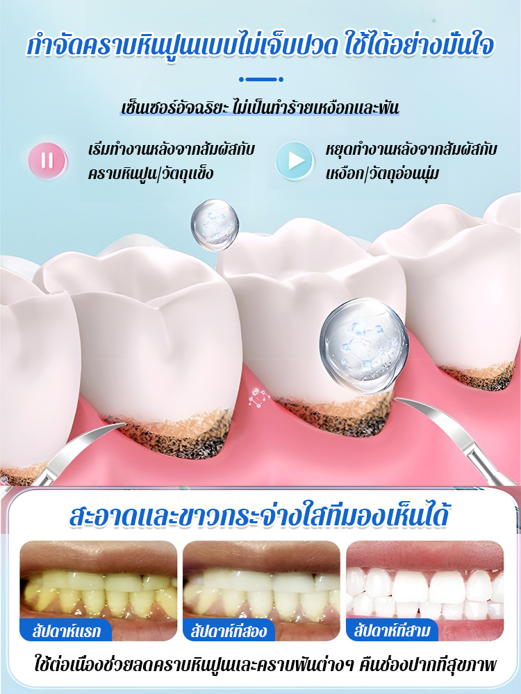  เครื่องทำความสะอาดฟันแบบอัลตราโซนิกที่แท้จริง