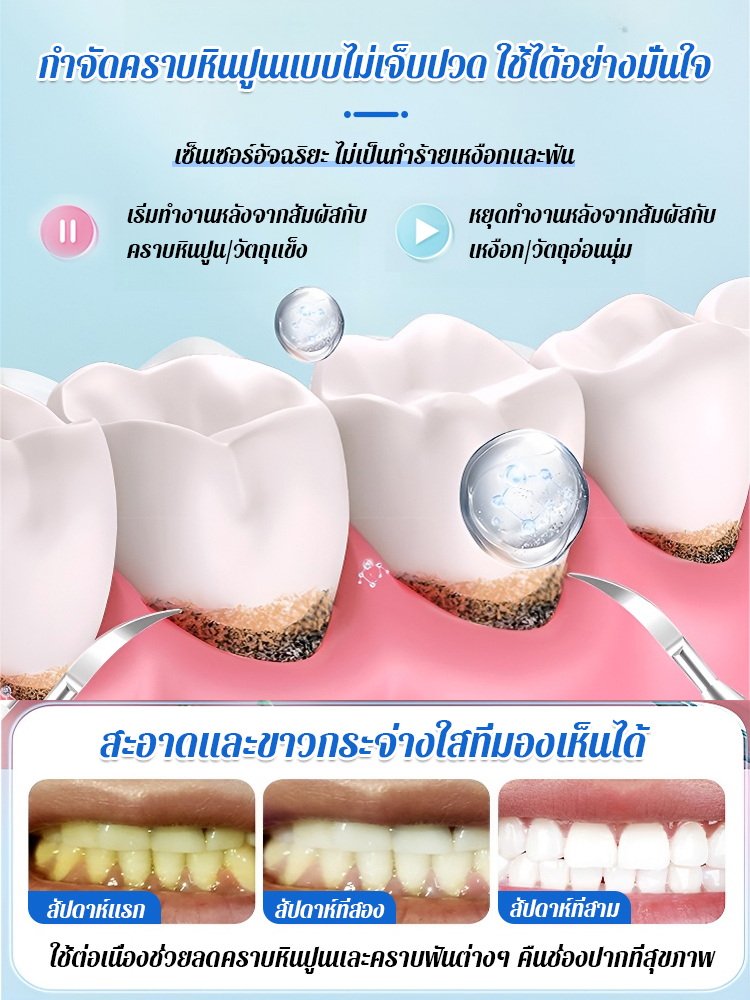  เครื่องทำความสะอาดฟันแบบอัลตราโซนิกที่แท้จริง