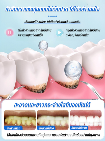  เครื่องทำความสะอาดฟันแบบอัลตราโซนิกที่แท้จริง
