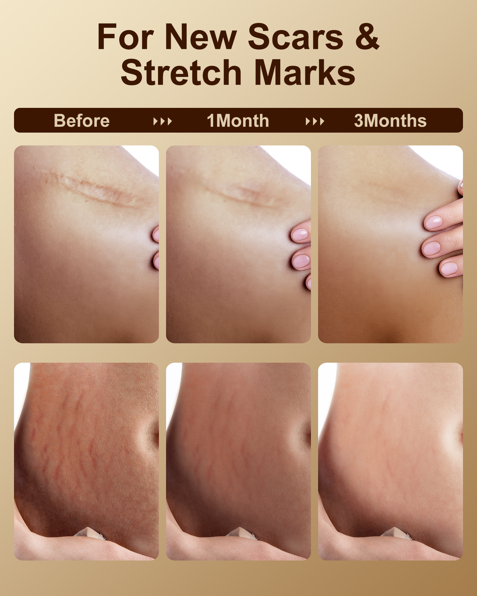 FLOWHYET Pure Vitamin E Oil for Skin 10 fl oz, Organic Lightweight Vitamin E Oil for Scar, Stretch Marks, Fast-Absorbing Body Oil Moisturizing and Firming Skin, Cold Pressed-300ml