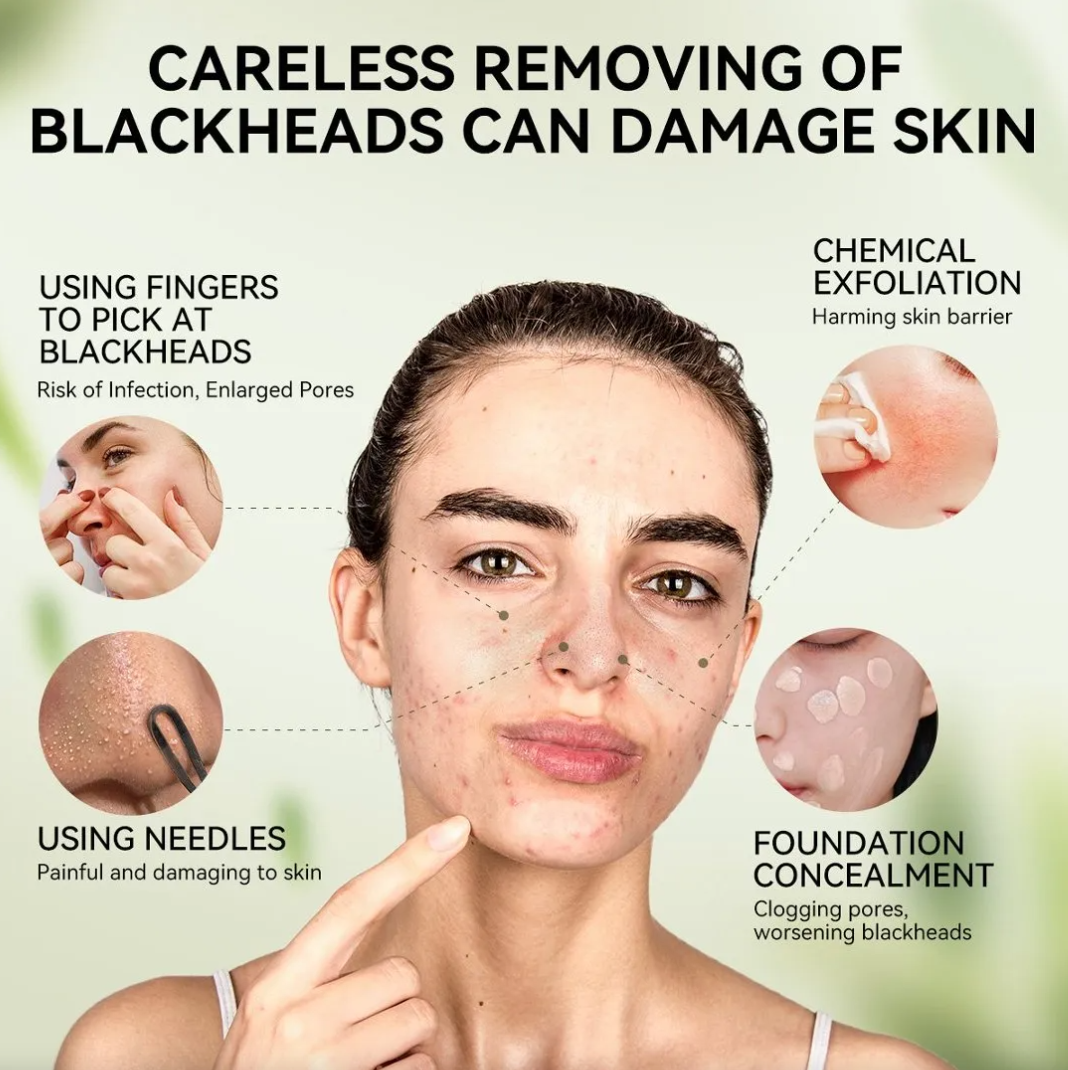 Lanbena 3.0 Máscara Facial Removedora De Cravos 30g Charcoal