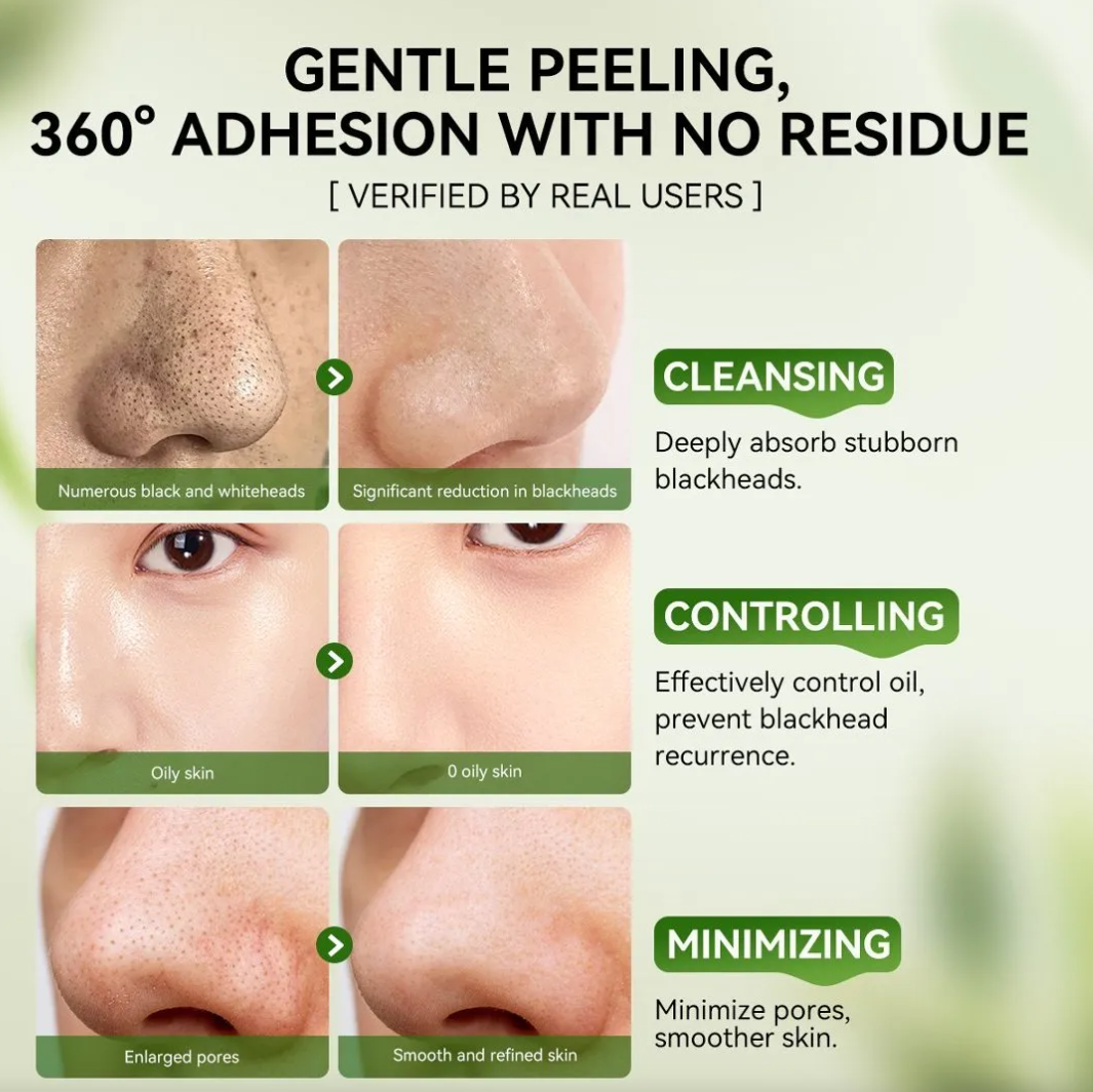 Lanbena 3.0 Máscara Facial Removedora De Cravos 30g Charcoal