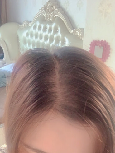 การเจริญเติบโตของเส้นผมอย่างรวดเร็วและหนาขึ้น