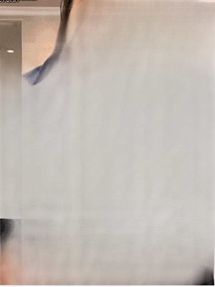 รอยแย่งศีรษะเริ่มกว้างขึ้นเรื่อยๆเหรอ? 💇‍♀️ไม่ต้องกังวล! เอสเซนส์บำรุงผมแข็งแรงและส่งเสริมการงอกใหม่ ซึมลึกถึงรูขุมขน หนึ่งขวดจบ