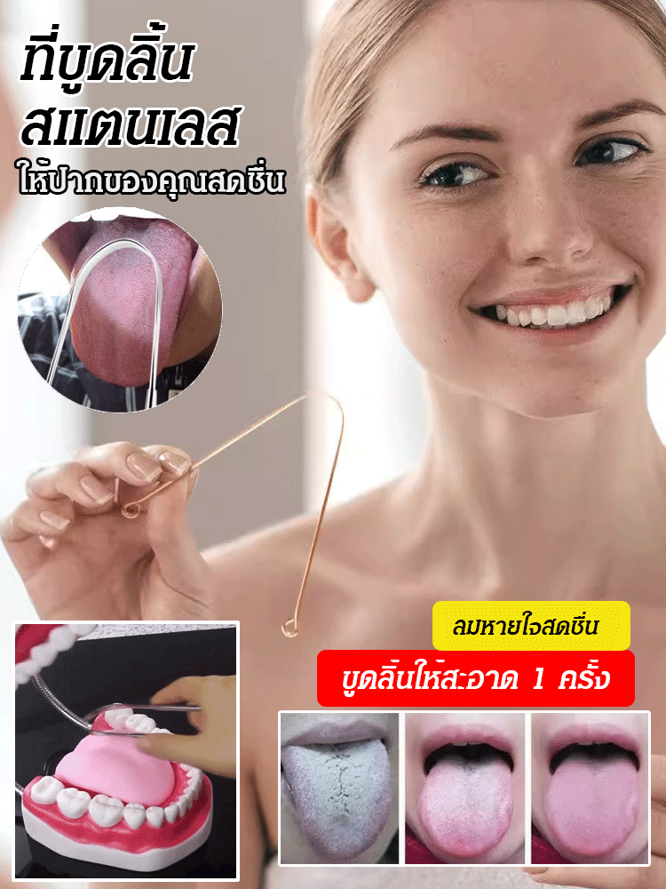 ที่ขูดลิ้นสแตนเลส 304 ทำความสะอาดฝ้าบนลิ้น