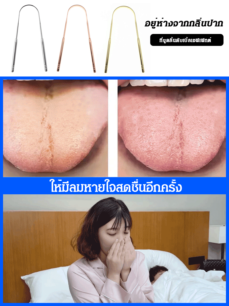 ที่ขูดลิ้นสแตนเลส 304 ทำความสะอาดฝ้าบนลิ้น