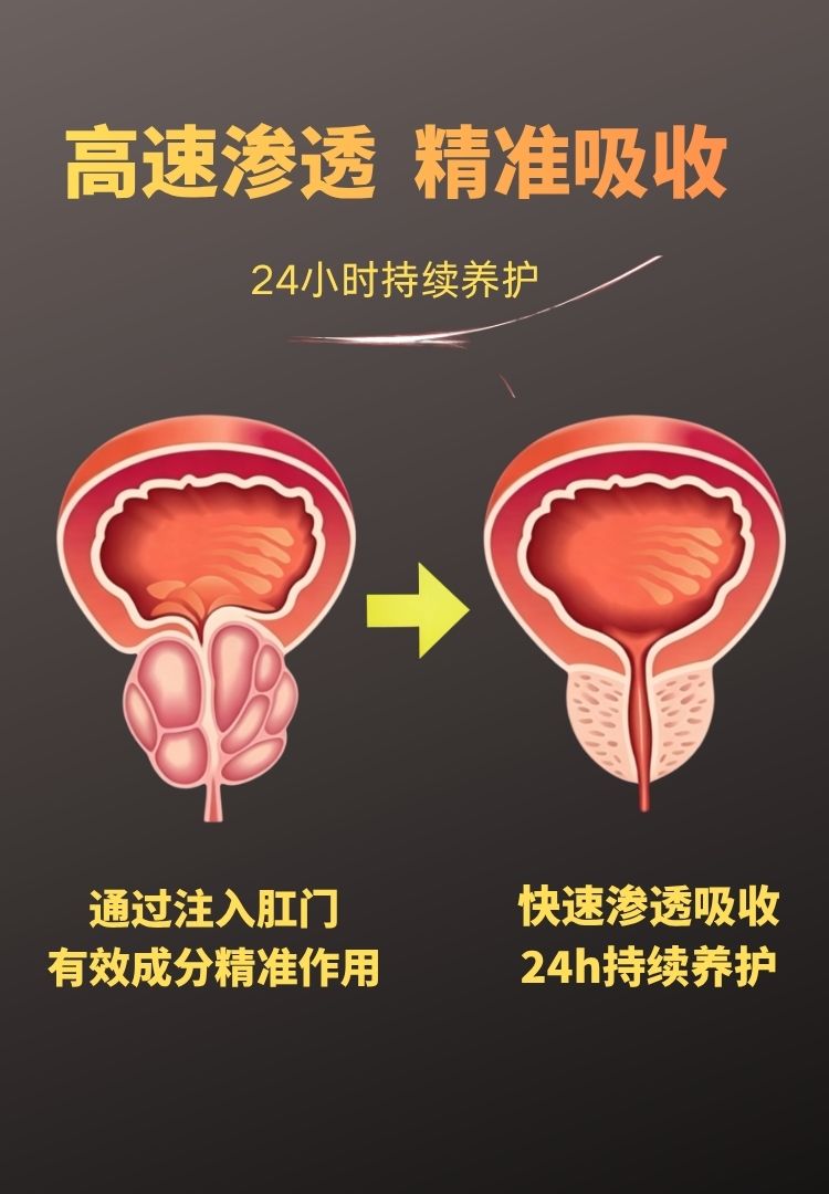 男性补肾壮阳凝胶