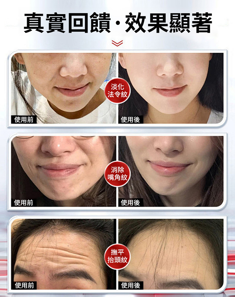 童顏緊緻拉皮霜