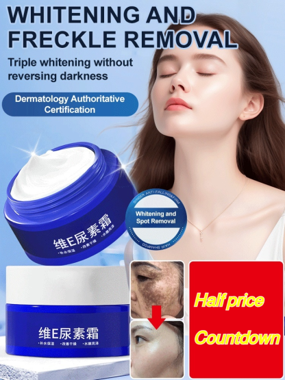 【Old Spots and Yellow Spots Disappear】Spot Fading Urea Cream