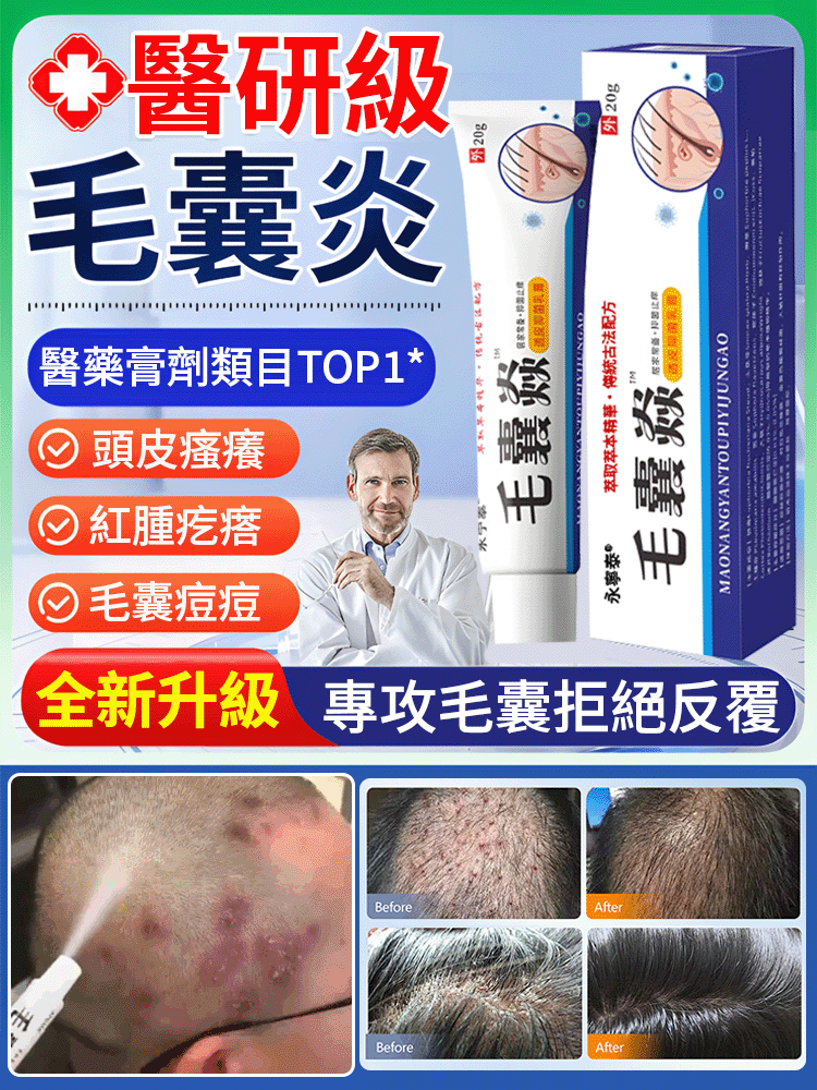 頭皮祛痘止癢毛囊膏