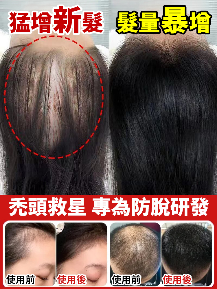 防脫固髮精華液