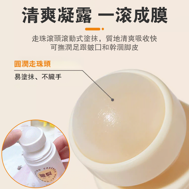 足跟皴裂凝露