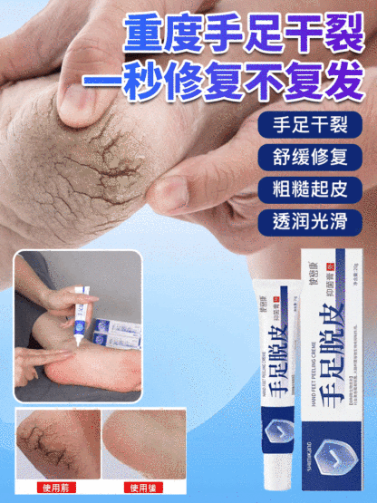 【一抹光滑】手足脫皮抑菌膏